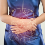 Ilustração de uma mulher com dor abdominal, destacando o sistema digestivo, relacionado ao tumor estromal gastrointestinal (GIST).